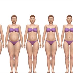  How Carbohydrate Blocker Cause Weight Loss In Obesity?